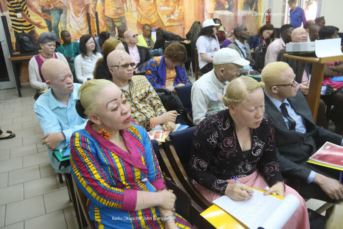 L'urgence de protéger les albinos à Lubumbashi